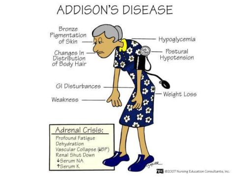 What is a strange symptom of Addison disease?